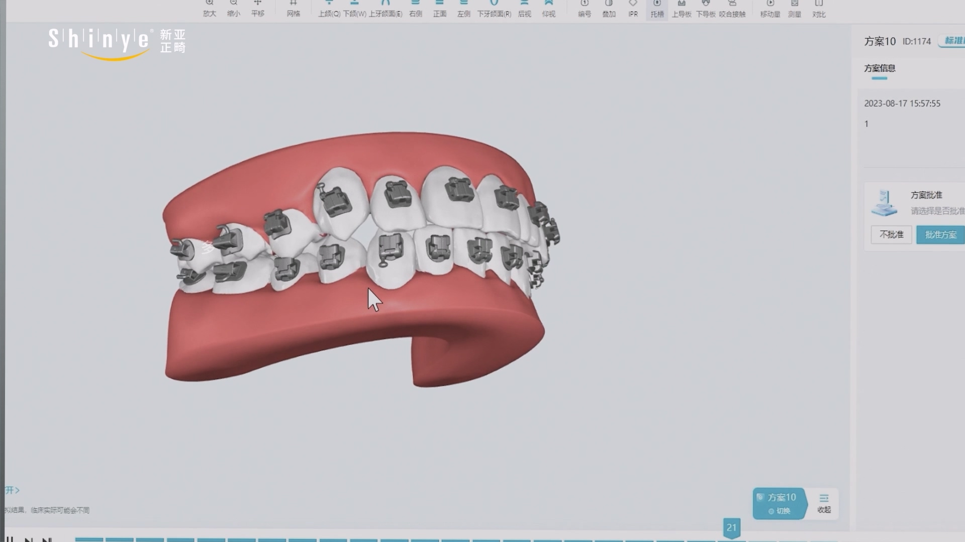 20230906引导粘接导板.mp4_20251022_102244.154.jpg 嘉兴正畸托槽引导装置三维动画口腔医疗设备展示案例截图